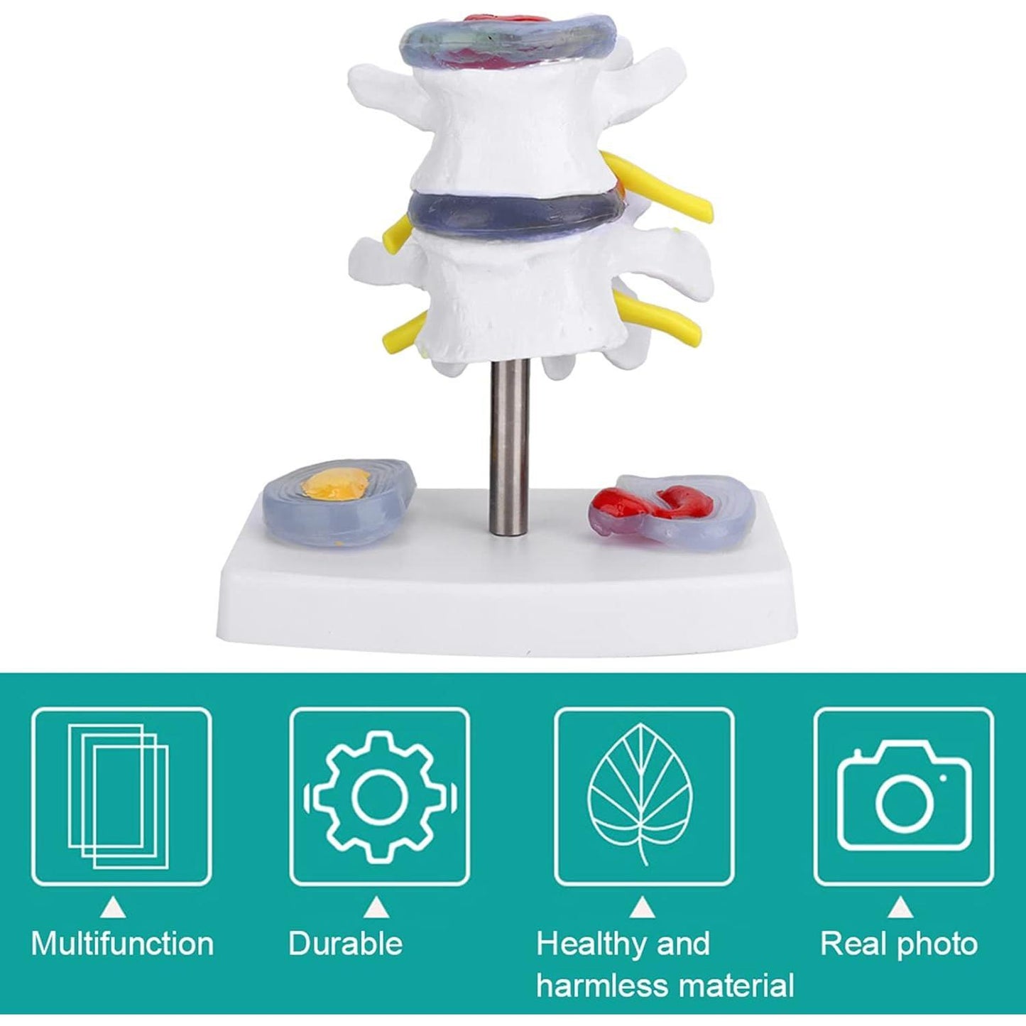 Human Spine Model, Anatomical Lumbar Disc Herniation Demonstration Model School Training Skeleton Spine Model Educational Tool for Exhibitions